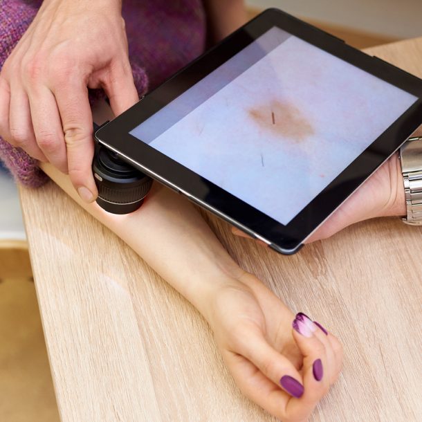 dermatología digital